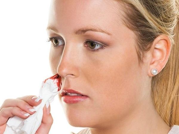 Nằm mơ thấy mình chảy máu mũi có ý nghĩa gì, cảnh báo gì?