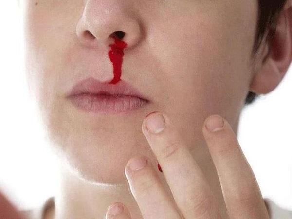 Ý nghĩa giấc mơ thấy mình chảy máu mũi